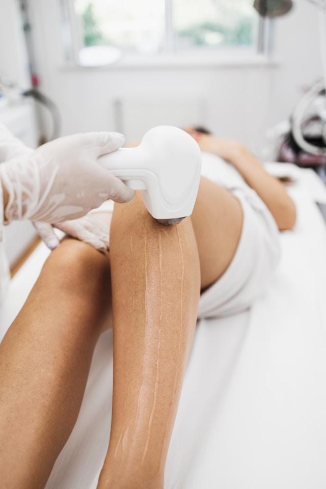 Laser hair removal treatment